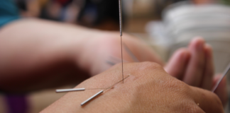 Acupuntura: Aliada da Saúde no Inverno na Clinibeira