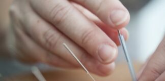 Acupuntura: terapêutica é aliada no combate aos problemas de saúde durante a Primavera