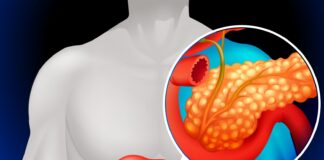 Brasil: Estudo com “daraxonrasib” amplia a sobrevida nos casos de cancro de pâncreas, avalia oncologista